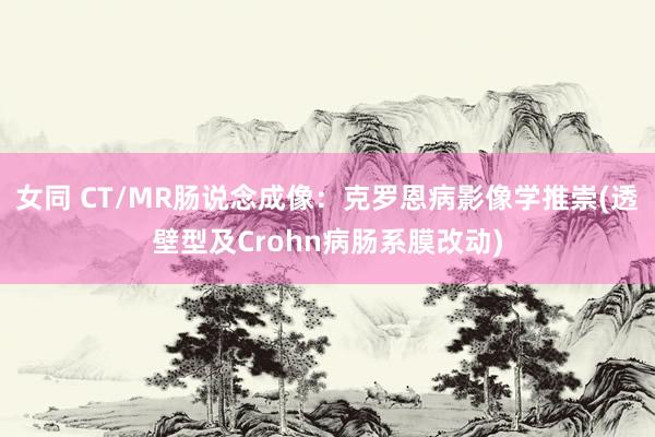 女同 CT/MR肠说念成像：克罗恩病影像学推崇(透壁型及Crohn病肠系膜改动)